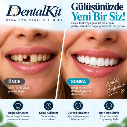 DentalKit™ Şekillendirilebilir Estetik Diş Kaplaması